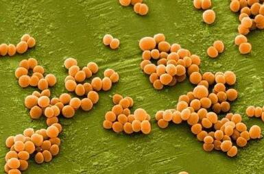 Nature：重大突破！揭示益生菌芽孢杆菌清除金黄色葡萄球菌机制